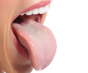 혀에 낀 백태가 ‘구강질환’ 의심 신호?