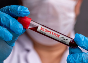 브라질 엠폭스(원숭이두창), 상파울루 집중… 백신 부족에 시민 불안