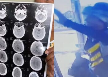 “담당 의사 이름까지 대며 접근했다”…브라질 발칵 뒤집은 ‘건강검진 배달’ 사기